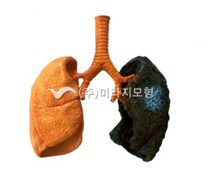 인체모형(폐)